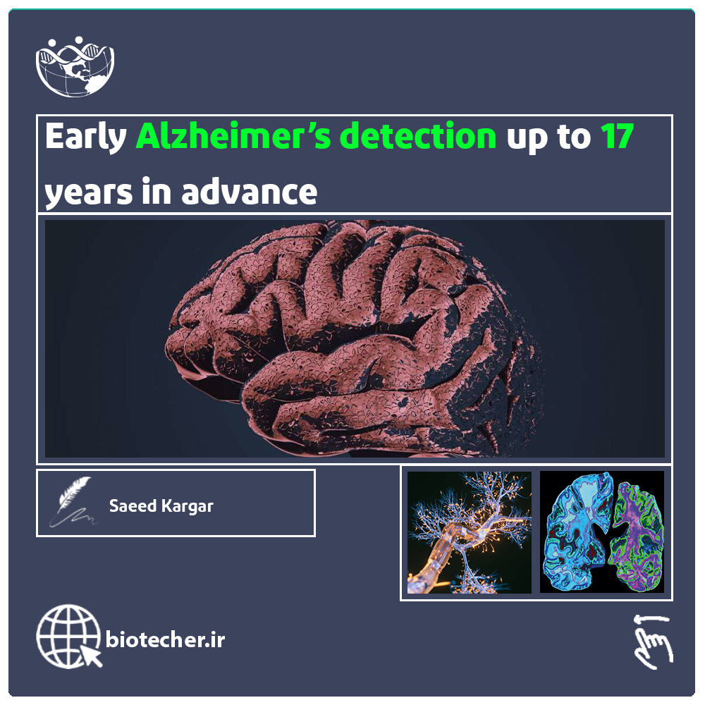 تشخیص زود هنگام آلزایمر 17 سال قبل از رخ دادن آن