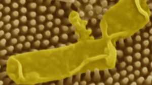 تصویر میکروسکوپ الکترونی از سطح پوست مارمولک که موجب ایجاد سوراخ در دیواره ی باکتری و مرگ آن می شود