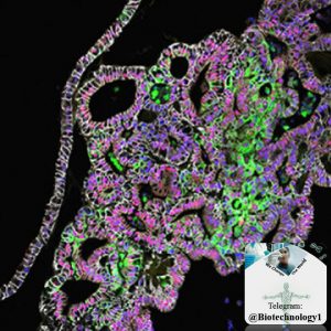تصویر میکروسکوپی کانفوکال از سلول های بنیادی مهندسی شده انسان که تبدیل به بافت معده شده است. (بیوتکنولوژی)