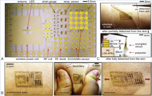 اپیدرمال الکترونیک (Epidermal Electronics)