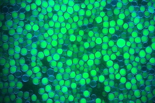 تولید روغن های میکروبی به وسیله مخمر Yarrowia lipolytica می باشد که روغن های درون سلول به رنگ سبز و دیواره سلولی به رنگ آبی نشان داده شده است.
