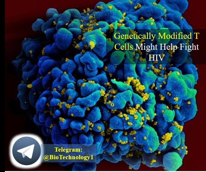 حمله به HIV به کمک سلول های T دستکاری ژنتیکی شده