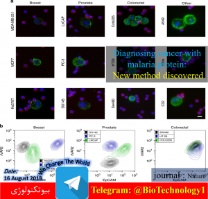 ابداع روش نوین در تشخیص سرطان | تشخیص سرطان برپایه پروتئین مالاریایی | تشخیص سرطان | پروتئین مالاریایی | دانشگاه کوپنهاگن دانمارک | انگل مالاریا | بیومارکر | سلول‌های سرطانی