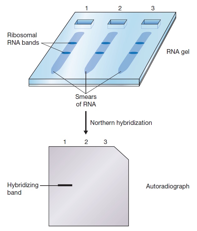 تکنیک نوردن بلاتینگ | Northern Blotting | تصویر ۲ . هیبریداسیون Northern؛ سه نمونه RNA استخراج‌شده از بافت‌های مختلف در ژل آگارز الکتروفورز شده‌اند. این نمونه‌ها حاوی مولکول‌های RNA فراوانی با طول‌های مختلف هستند و درنتیجه در اثر الکتروفورز اسمیری از RNA ها به دست می‌آید. دو نوار واضح وجود دارند که مربوط به RNAهای ریبوزومی می‌باشند. اندازه این مولکول‌ها مشخص است و درنتیجه می‌توانند به عنوان مارکرهای داخلی سایز استفاده شوند. ژل به غشا انتقال داده می شود، با ژن کلون شده پروب می‌گردد و نتایج با روش‌هایی مانند اتورادیوگرافی، قابل مشاهده می‌شوند. تنها در ستون اول نوار تشکیل می‌شود که نشان‌دهنده بیان ژن کلون شده، تنها در بافتی است که RNA استخراج شده از آن تهیه شده است.
