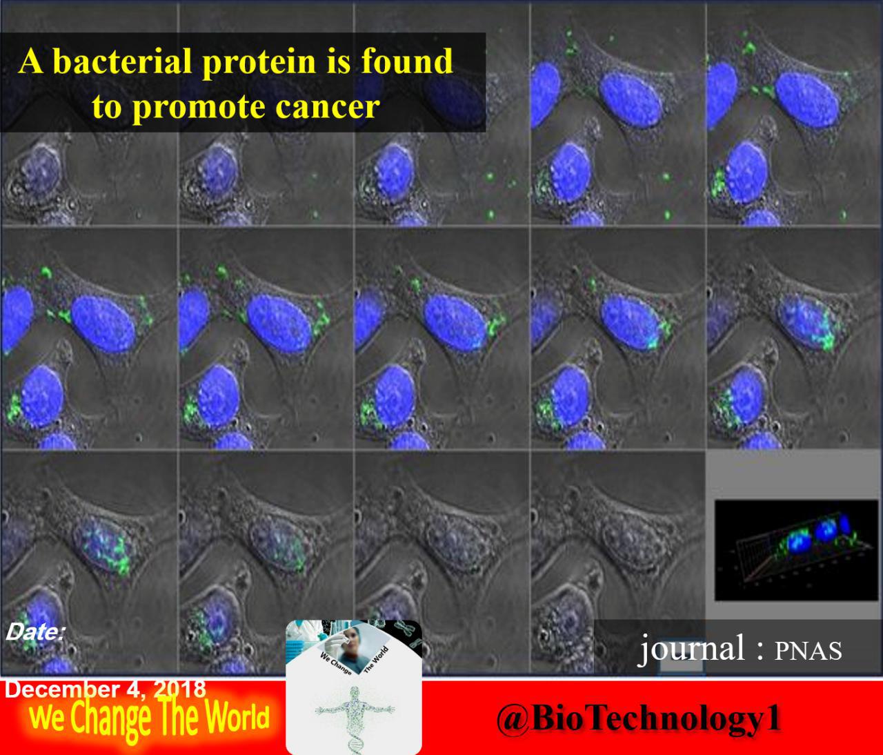 پروتئین باکتریایی که موجب پیشرفت سرطان می شود