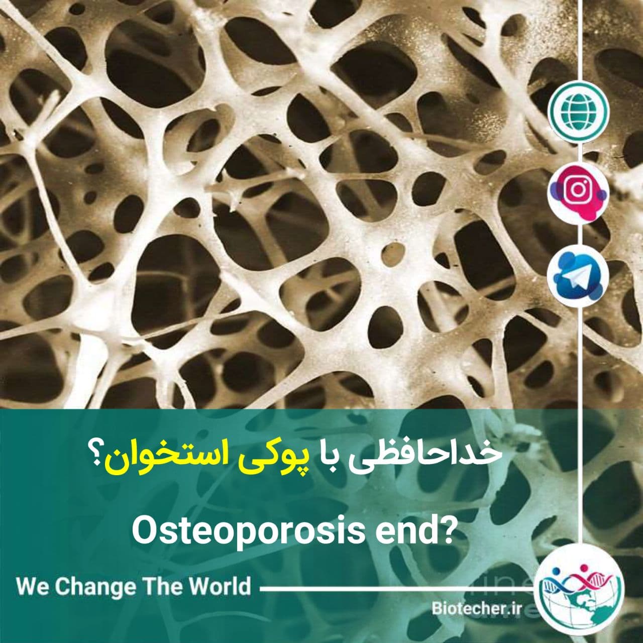خداحافظی با پوکی استخوان – osteoporosis end