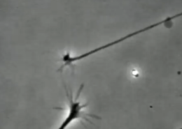 اتصال عاشقانه دو نورون در زیر میکروسکوپ - بیوتکر