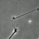 اتصال عاشقانه دو نورون در زیر میکروسکوپ