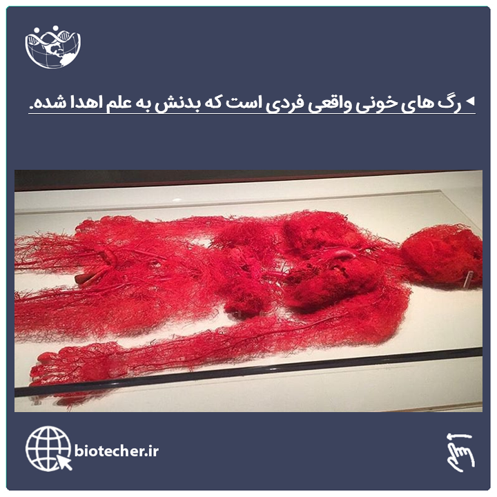 نمایی از رگ های خونی واقعی بدن 