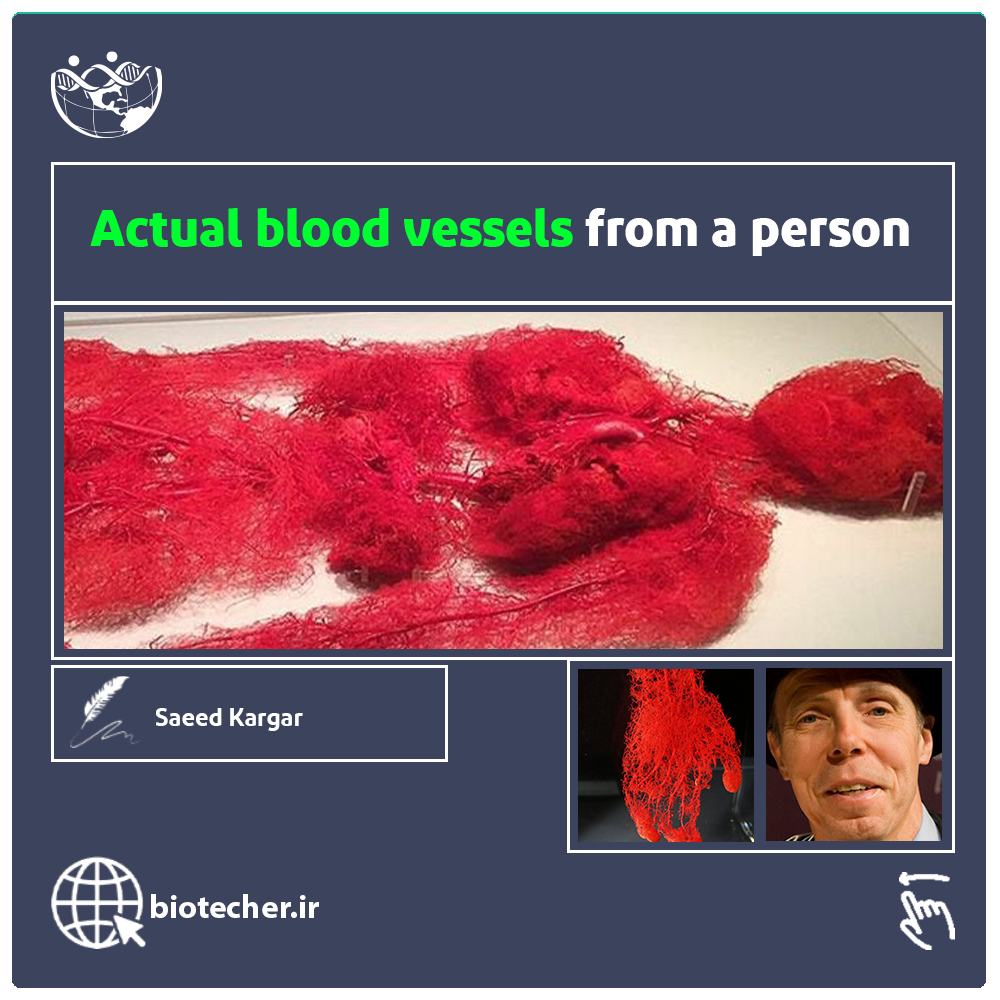 نمایی از رگ های خونی واقعی بدن