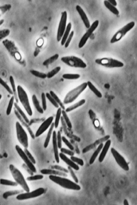 بیوتکنولوژی میکروبی چیست؟ کاربردهای باکتری Clostridium acetobutylicum در بیوتکنولوژی - باکتری کلستریدیوم استوبوتیلیکوم